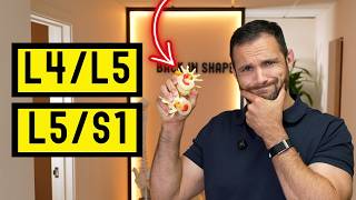 腰椎椎間板手術：L5、S1椎間板切除術後の戦略