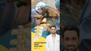 what are the causes and symptoms of osteoporotic spine fracture || Dr.Dheeraj Batheja || Spine