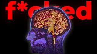 Your Brain is F*cked. Here's How to Fix It
