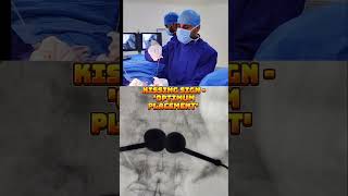 Cementing the spine is RISKY ??? #safety #kyphoplasty #osteoporosis #treatment #shorts #ytshorts