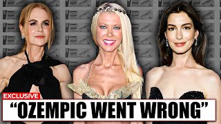 60 Most SHOCKING Celebrity OZEMPIC Transformations of 2025 That Backfired