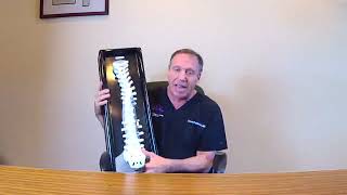 Scoliosis Management, Diagnosis and Treatment / David S. Feldman, MD