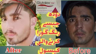 Glutalex capsule (Glutathione) skin whitening capsule for permanently and other uses, side effects
