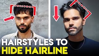 6 Hairstyles for Receding Hairline SOLUTION + Treatments