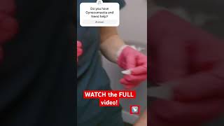 Life-Changing Gynecomastia Surgery: A Patient’s Journey to Confidence! #gynecomastia #patientsuccess