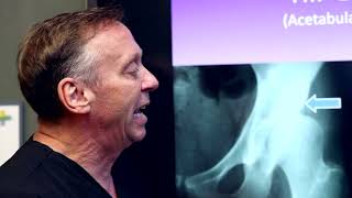 Adult Hips: Common Issues that Arise / David S. Feldman, MD