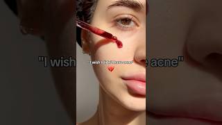 Here is what REALLY worked for my acne...😱