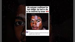 Truth about Michael Jackson’s skin changes #celebritygossip #michaeljackson #mj #celebritynews