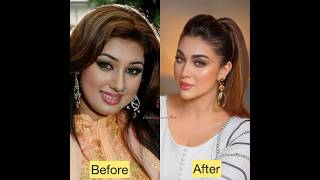 Before and After V shape | Opu biswash, Bubly, Toma mirza , Joya Ahsan, Nusrat Faria, Puja cherry