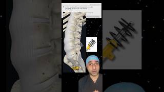 Sitting and backpain. All you need to know! #disc #backpain #office #surgeon #awareness #shorts