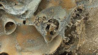 Lung Cancer Visualization by HiP-CT (Hierarchical phase-contrast tomography)