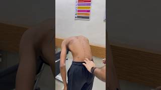 Scoliosis detection in just 20 seconds # #spine #scoliosisawareness #chiropractic