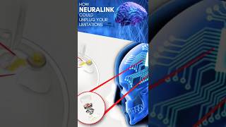 Elon Musk's #Neuralink ? Restoring Vision with Brain Implants! #BrainChip #Ethics ⚡️