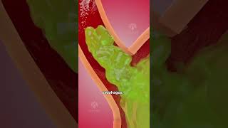 How acid reflux happens 🥵  Acidity and gas problem | GERD #shorts #viralvideo - creativelearning3d