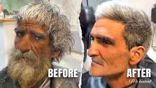 Before and after our 85-year-old homeless man whose face changed