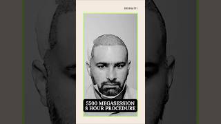 Hair Transplant in India | Best Results at Best Cost of Hair Transplant