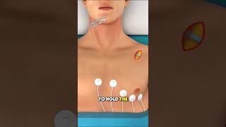 pacemaker function and its installation #medfacts #medical #medicalstudent #medicaleducation