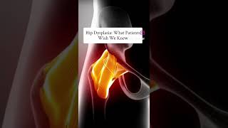 Hip Dysplasia