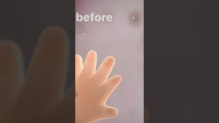 Ever wondered why we have fingerprints? #vianvision #genomics #sciencereels #crispr #geneticengineer