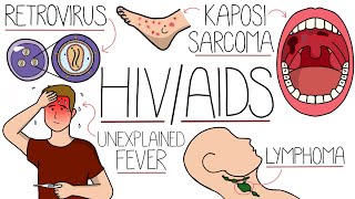 HIVとエイズ - ヒト免疫不全ウイルスについて解説