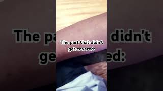 Baby skin under sleeve VS skin got exposed and bitten by mosquitoes