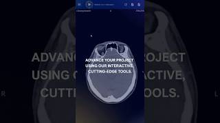 🚀 Interested in a STEM research project with a focus on Neuroscience? #stem #research #education