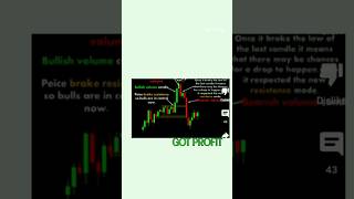 The TRUTH About Trader's PAIN!#money ,#earn,#stockmarket ,#trading ,#shorts ,#profitbooking #yt