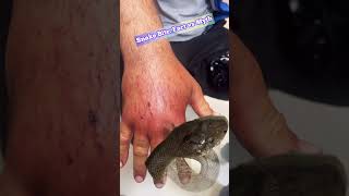 Debunking Myths: Snake Bite Treatments and Misconceptions