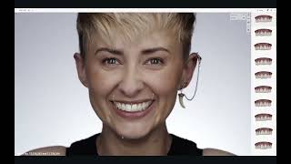 The Digital Revolution in Smile Design [Smile Cloud Part 2]