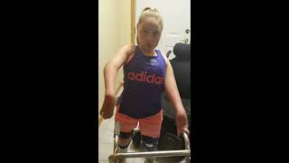 Arthrogryposis Diagnosis and Treatment / Patient Testimonial: Aubrey