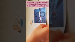 SLIPPED DISC: CAUSES, SYMPTOMS AND TREATMENT #slippeddisc #backpainrelief