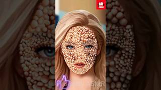 ASMR Animation Treatment for Infected girl face Trypophobia Animation #shorts