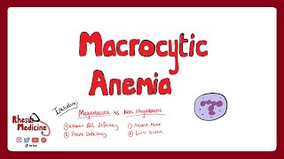 MACROCYTIC ANEMIA - Megaloblastic Anemia, Vitamin B12 and Folate Deficiency  | Rhesus Medicine