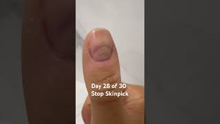 Day 28 of 30 - Right Thumb - Stop Skinpicking #progressjourney #journey #skincare #health