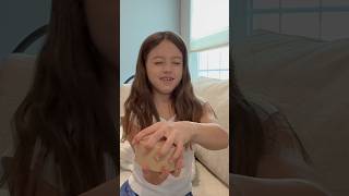 Guess Who Predicts RARE DUMPLING!? 😱 @RMS-USA #shorts #trending #omg #fun #fyp #unboxing #dog