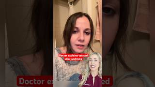 How a space heater could permanently scar your skin!