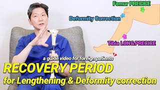 RECOVERY PERIOD for lengthening & deformity correction surgery
