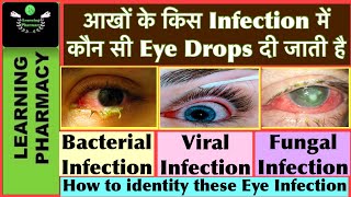 Different Eye Infections & their treatment || What kind of infection has happened, how to recognize