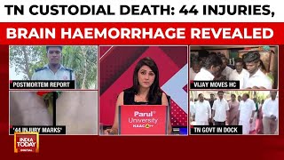 Tamil Nadu Custodial Death: Autopsy Reveals 44 Injuries, Brain Haemorrhage | India Today News