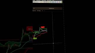 Trading Hack 🤯💀