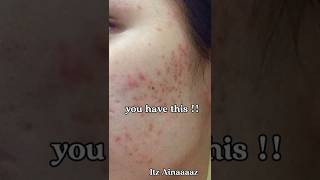 透明感のあるガラス肌に挑戦するための韓国の美容秘訣 #beautyinspiration #korean #glassskin #fy