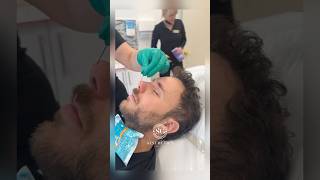 Nonsurgical Rhinoplasty🔥.                            #nonsurgicalrhinoplasty #nonsurgicaltreatment