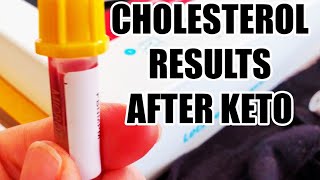 Cholesterol RESULTS 3 Years Keto | Let's Get Checked Review #ketotransformation