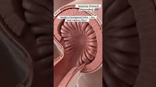 Inside a Constipated Colon You Won’t Believe This | Gut Health