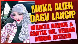 জেসমিনের ভিনগ্রহী মুখ নিয়ে নেট নাগরিকরা ঠাট্টা করছে, তার অনন্য ত্রিকোণাকার মুখের কারণে তীক্ষ্ণ চি...