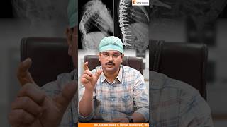 👶🧠Do Kids Have Spine Problems?Here’s What Every Parent Should Know!🧒🧍‍♀️#spinecare #spinehealthcare