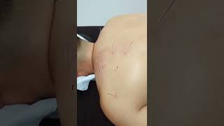 Shoulder & Upper Back Pain Relief: Fix Your Posture FAST!