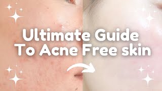 Ultimate Guide to Acne-Free Skin | Best Skincare Routine for Acne-Prone Skin| Skincare for acne