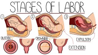 Stages of Labour Made Easy (Including The 3P's and Cardinal Movements!)