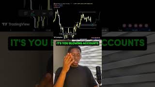 Do You Think You Can Trade 10 Million? #forex #currencyexchange #howtotradeforex